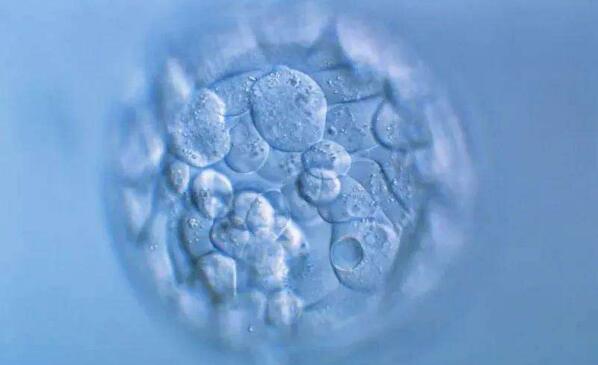 试管婴儿胚胎移植前、后都有哪些注意事项和常见的问题